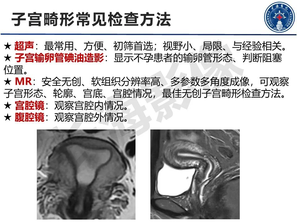 【PPT】子宫畸形的分类及MR诊断-3