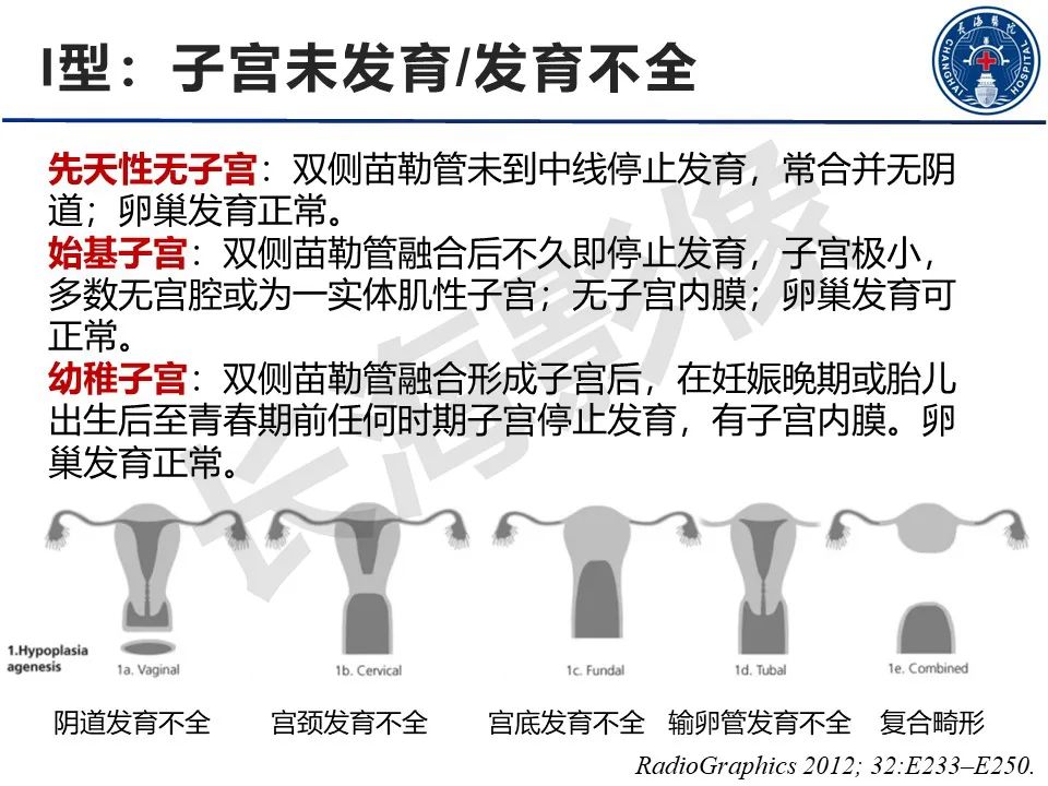 【PPT】子宫畸形的分类及MR诊断-7