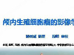 颅内生殖细胞瘤的影像学诊断