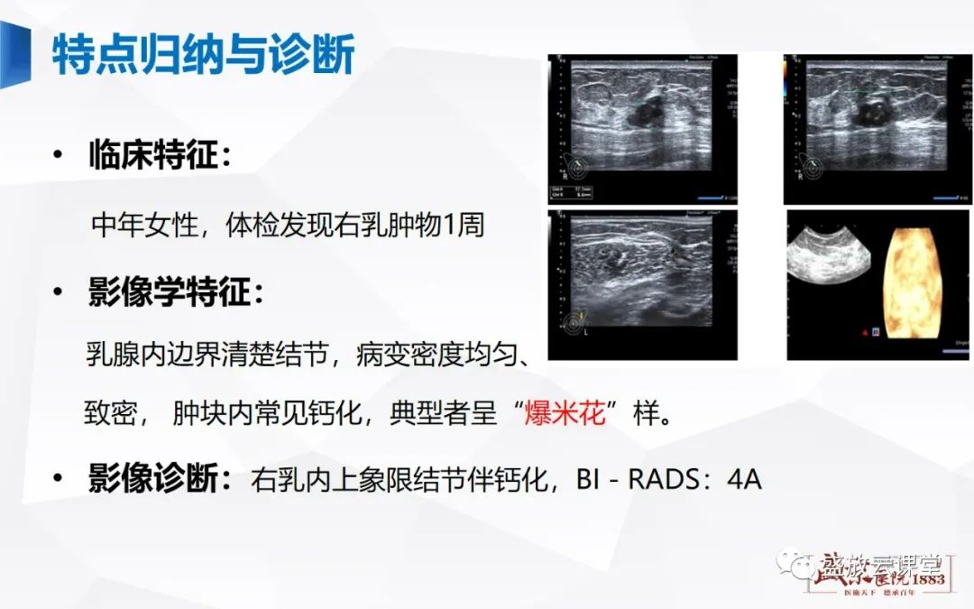 【PPT】乳腺疾病病例读片-16