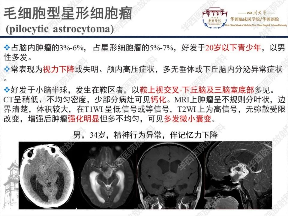 【PPT】颅咽管瘤1例MR影像鉴别诊断-14