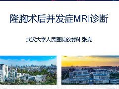 隆胸术后并发症MRI诊断