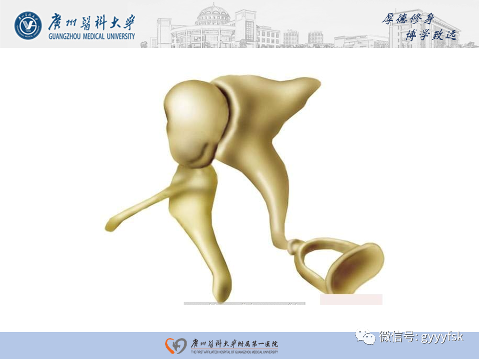 【PPT】中耳胆脂瘤影像阅片-12