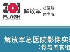颈椎脊索瘤1例MR影像