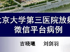 卵巢纤维-卵泡膜细胞瘤