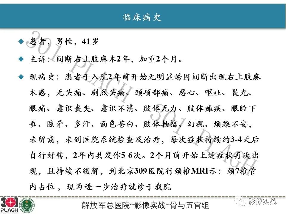 【病例】颈椎脊索瘤1例MR影像-2
