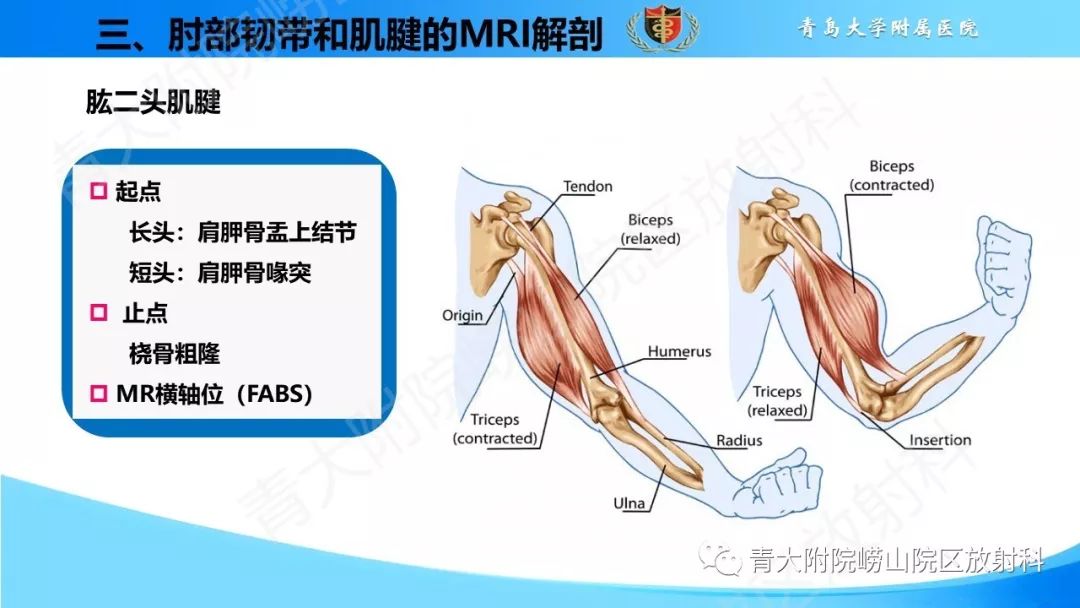 【PPT】肘部韧带和肌腱损伤的MRI诊断-20