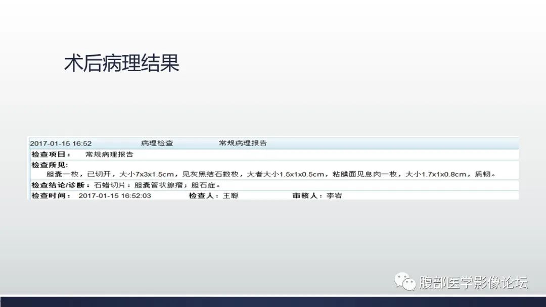 【病例】胆囊管状腺瘤1例CT及MR影像表现-9