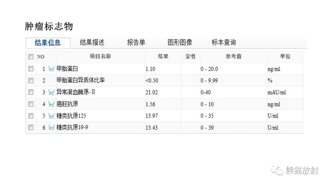 【病例】胰腺神经内分泌肿瘤2例CT及MR影像-3