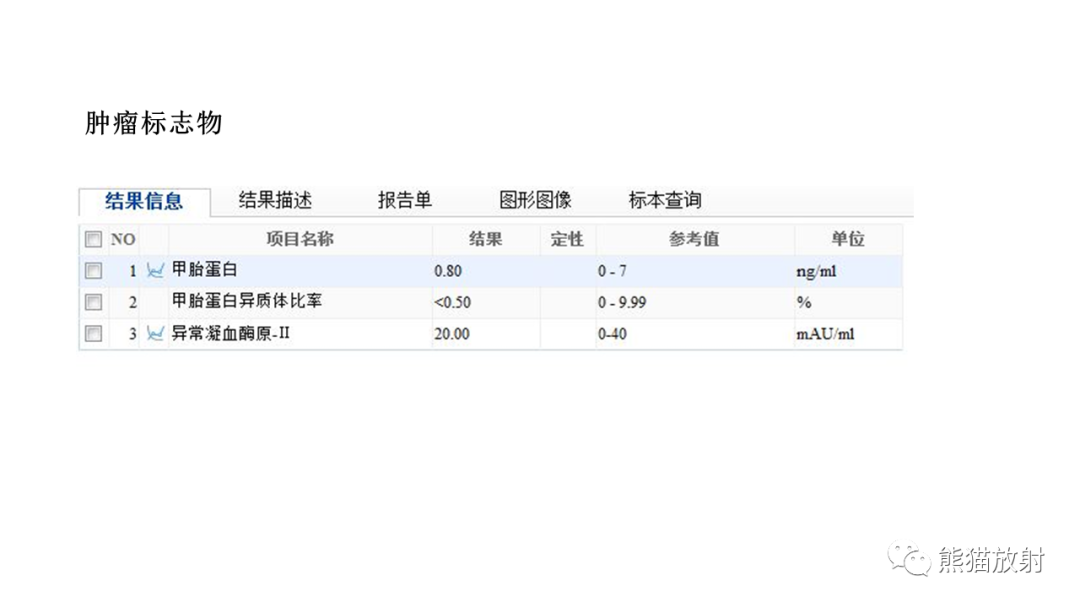 【病例】胰腺神经内分泌肿瘤2例CT及MR影像-10