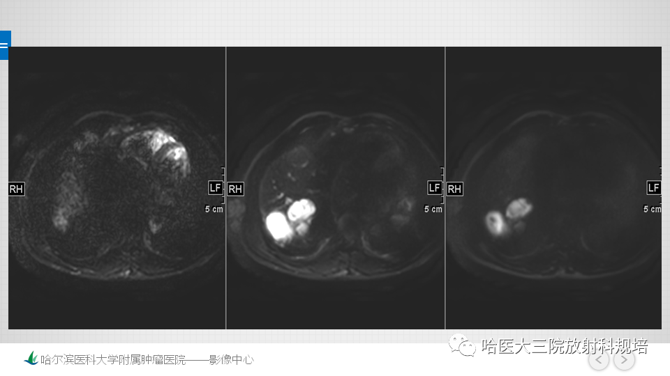 【PPT】肝脏扫描规范及常见问题-16