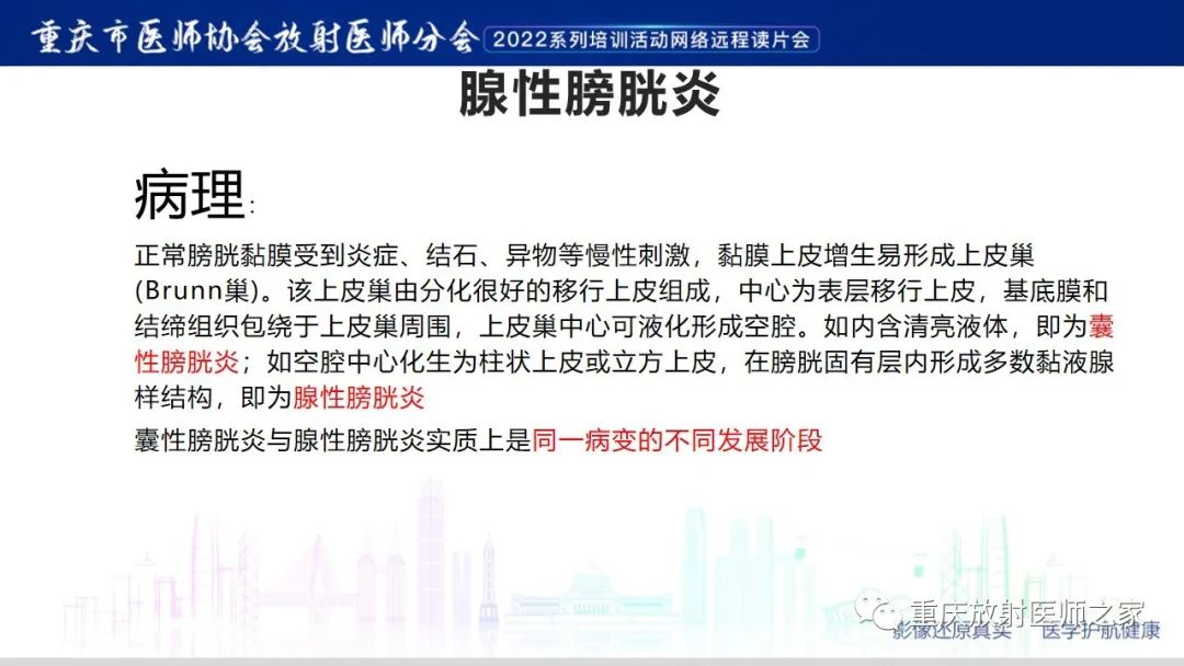 【病例】腺性膀胱炎1例CT影像-11