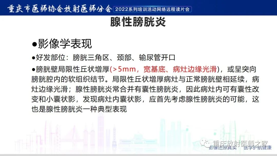 【病例】腺性膀胱炎1例CT影像-15