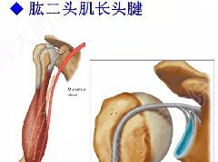 【PPT】肩关节运动损伤的MRI诊断