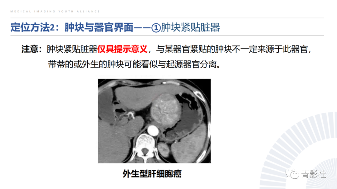 【PPT】左上腹肿块定位诊断思路-17