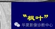 磨玻璃结节良恶性影像分析策略