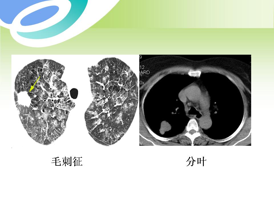 幻灯片6