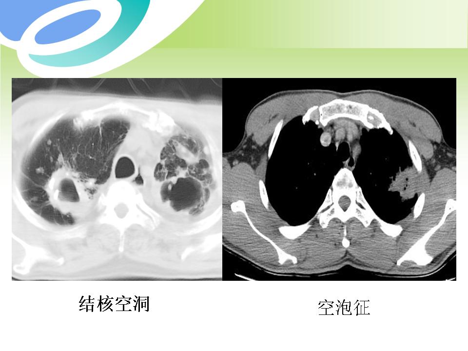 幻灯片11