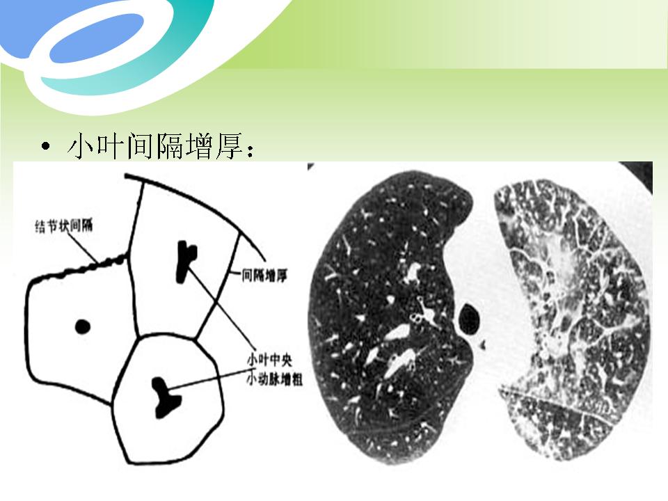 幻灯片32