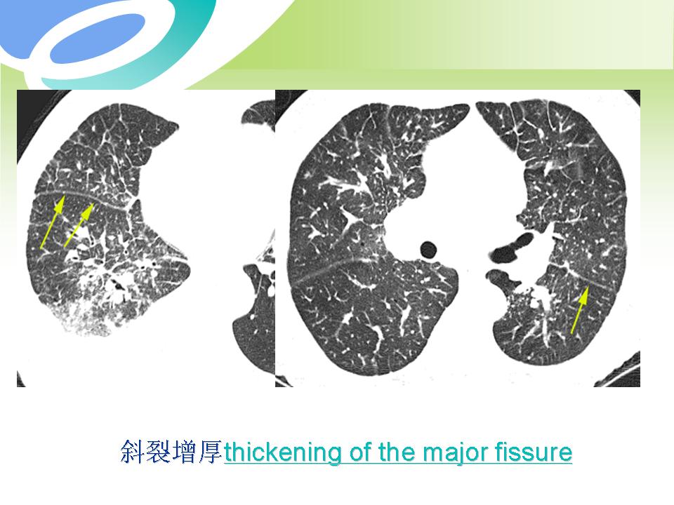 幻灯片36