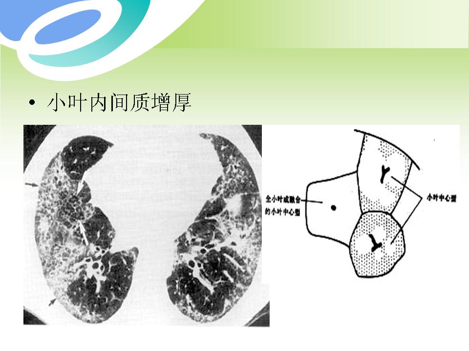 幻灯片37