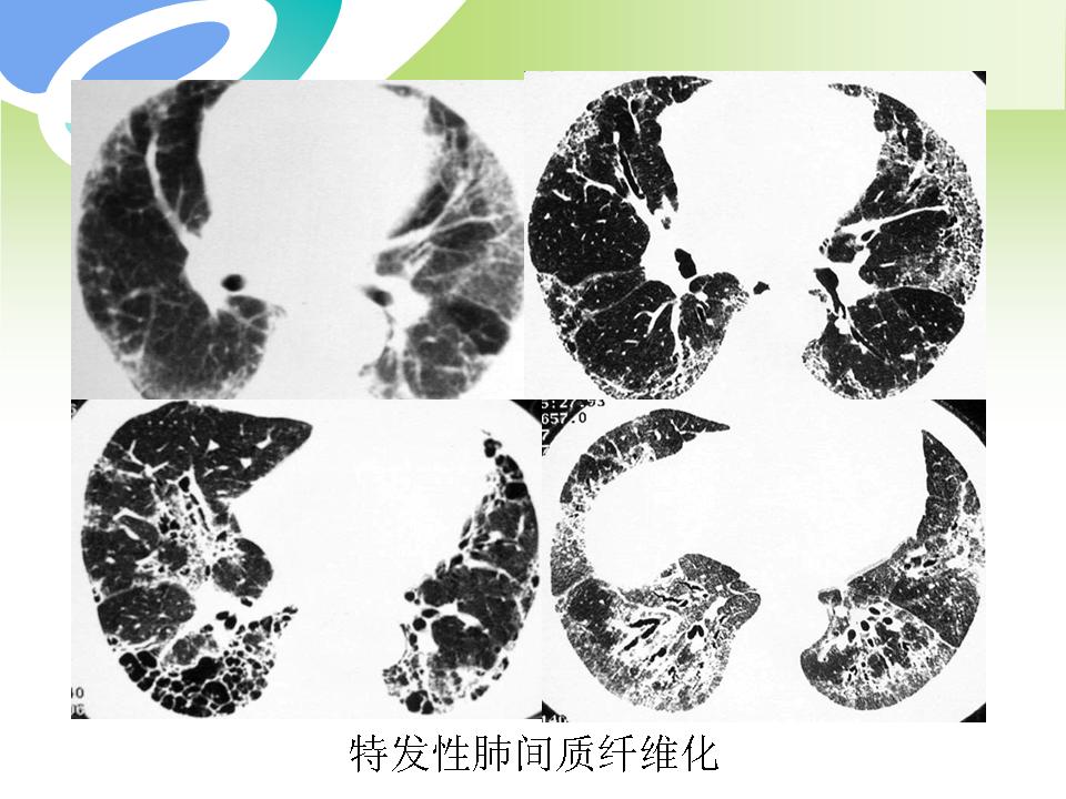 幻灯片38
