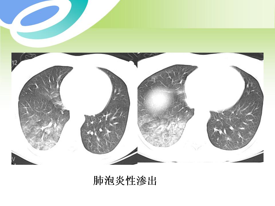 幻灯片60