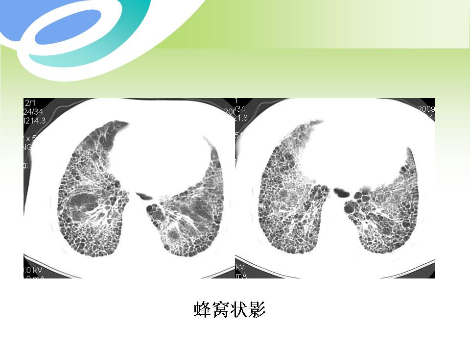 幻灯片75