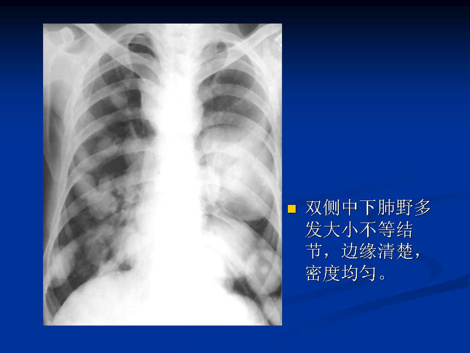 幻灯片6