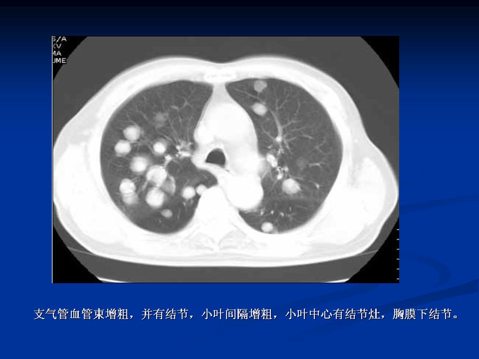 幻灯片9