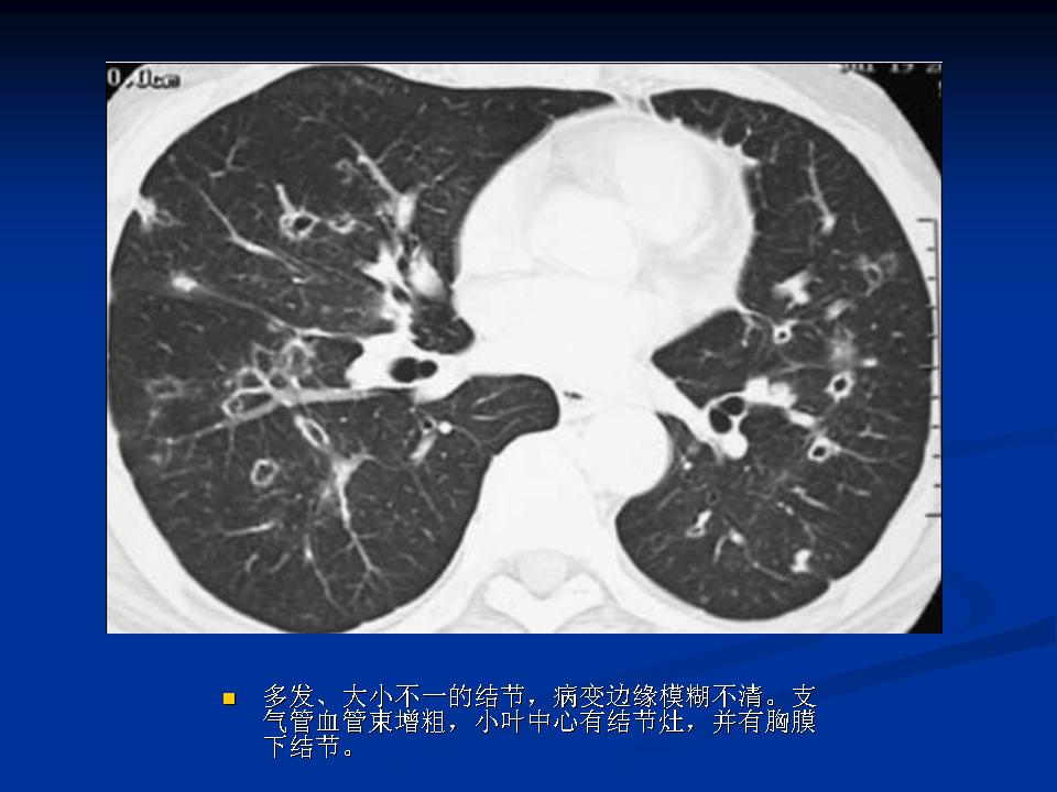 幻灯片11
