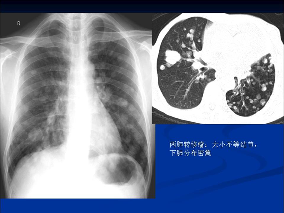 幻灯片12