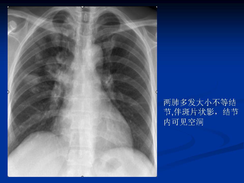 幻灯片17