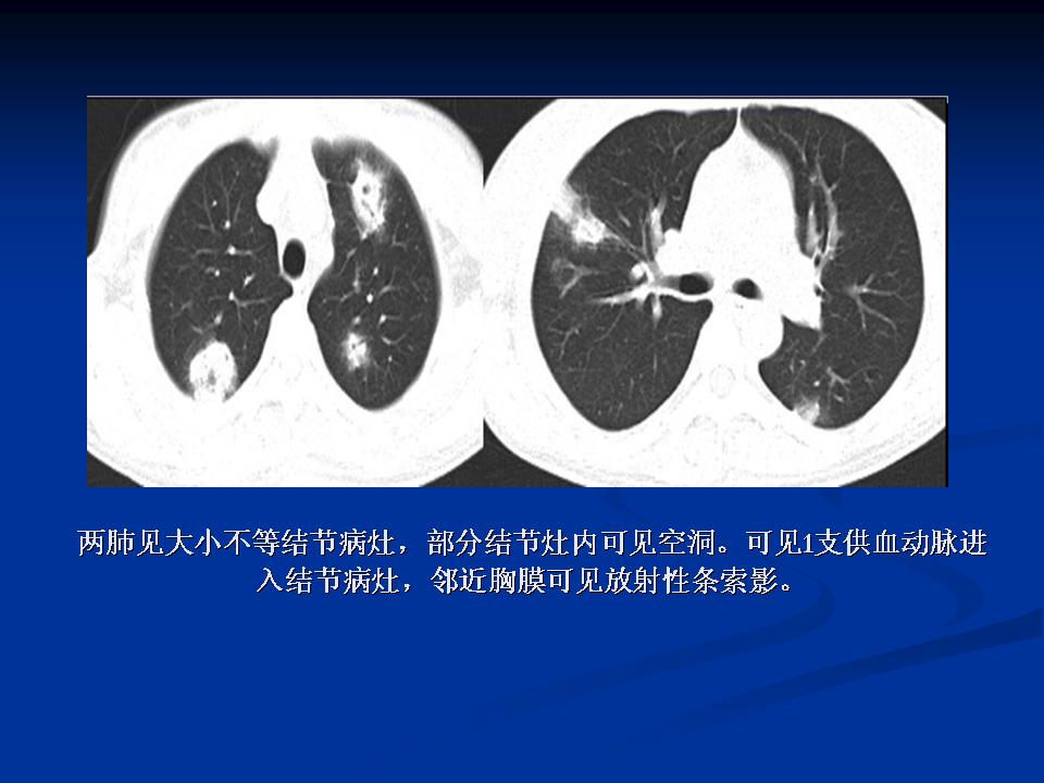 幻灯片20