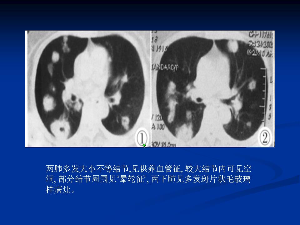 幻灯片21