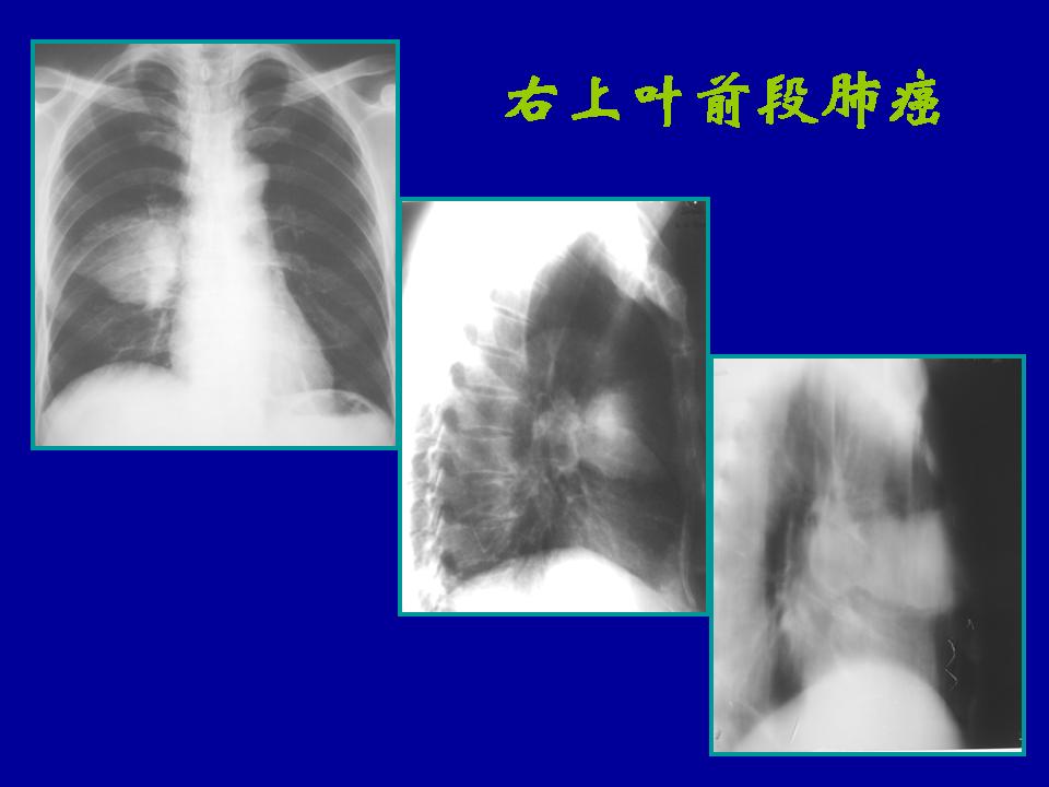 幻灯片32