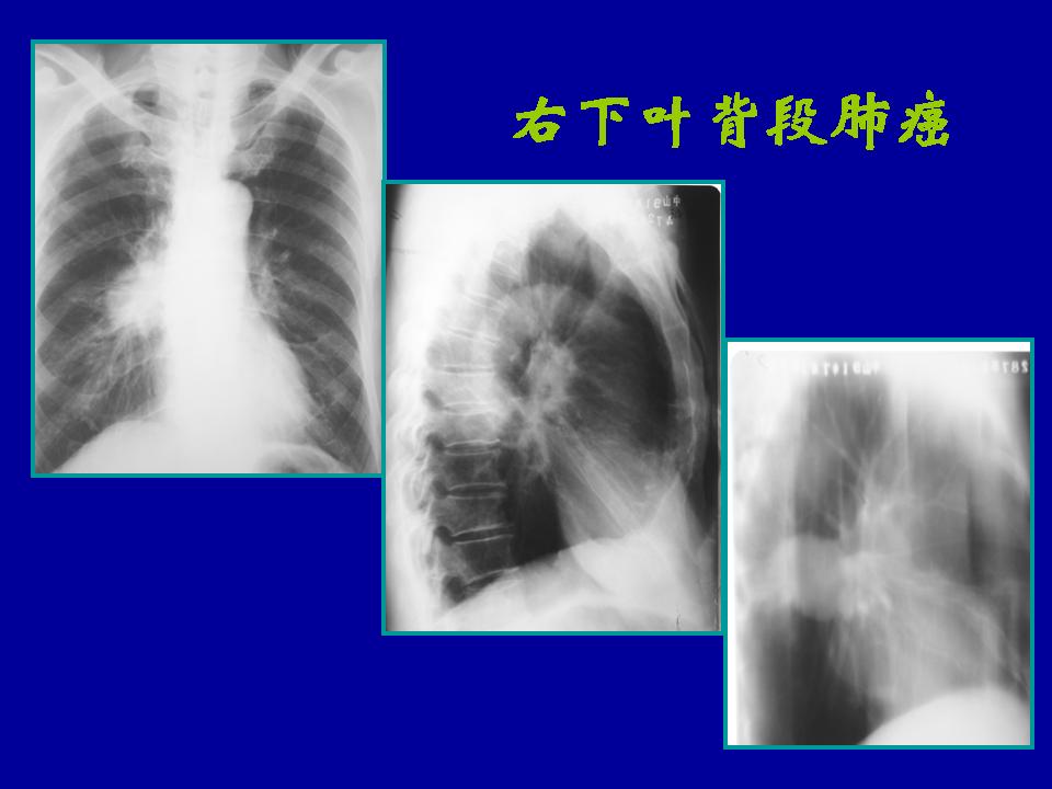 幻灯片31
