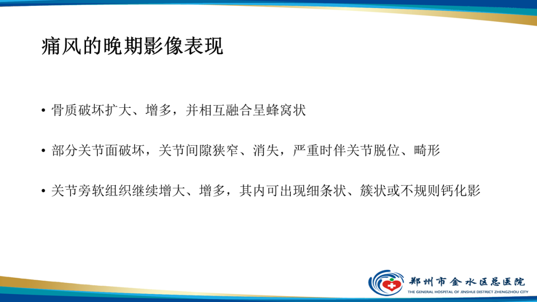 【PPT】痛风的影像诊断及鉴别诊断-20