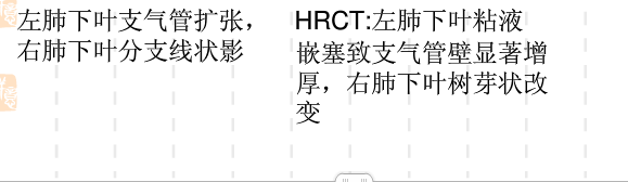 胸部CT常见征象详解|树芽征
