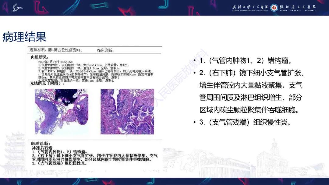 【PPT】成人气管支气管病变影像诊断-5