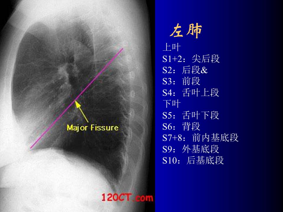 幻灯片11
