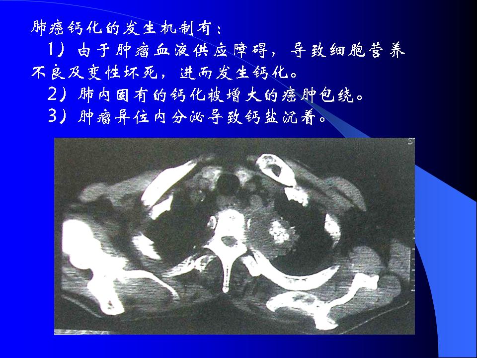幻灯片23