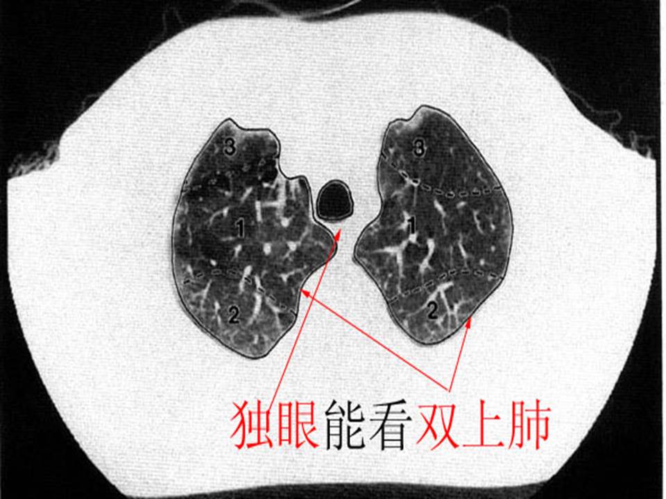 幻灯片15