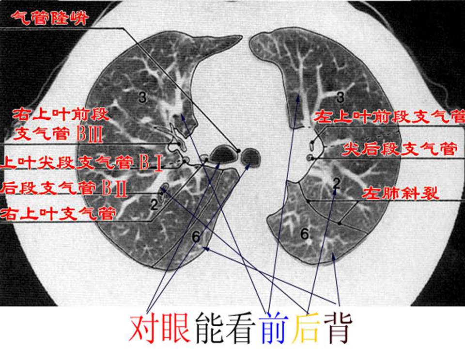 幻灯片17