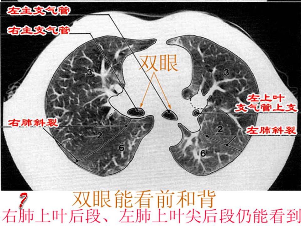 幻灯片18
