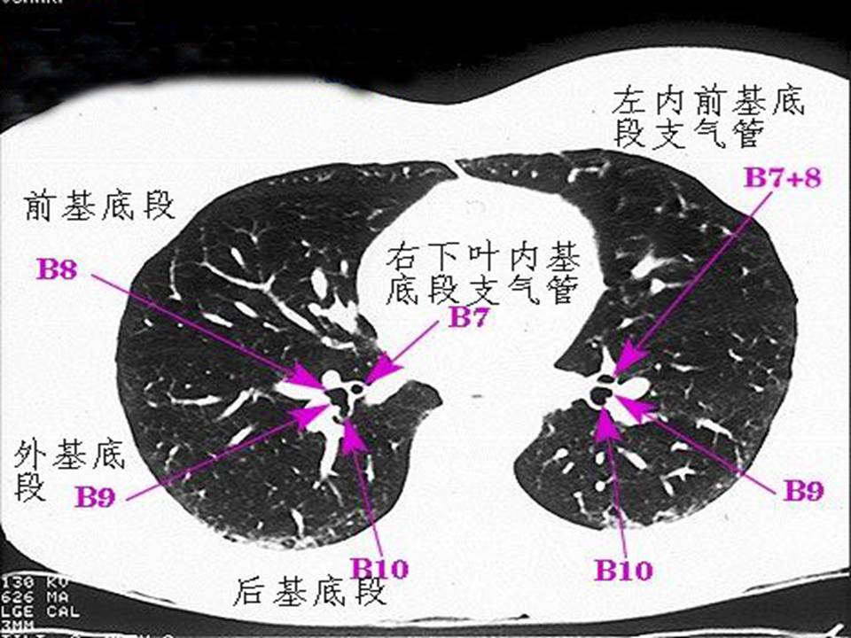 幻灯片26