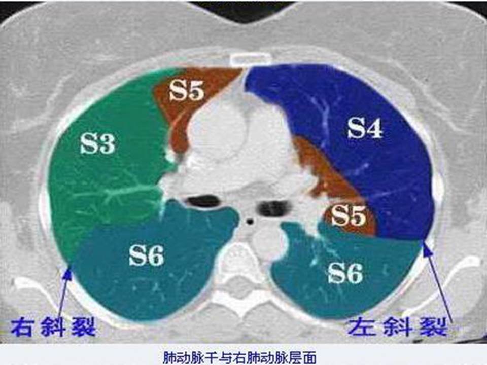 幻灯片31