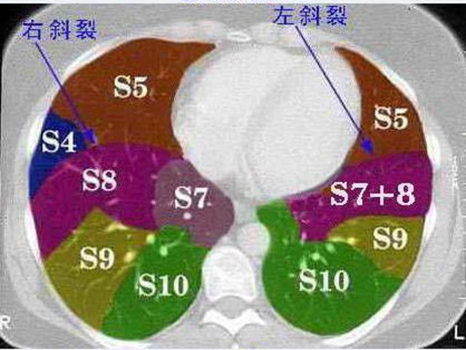 幻灯片33