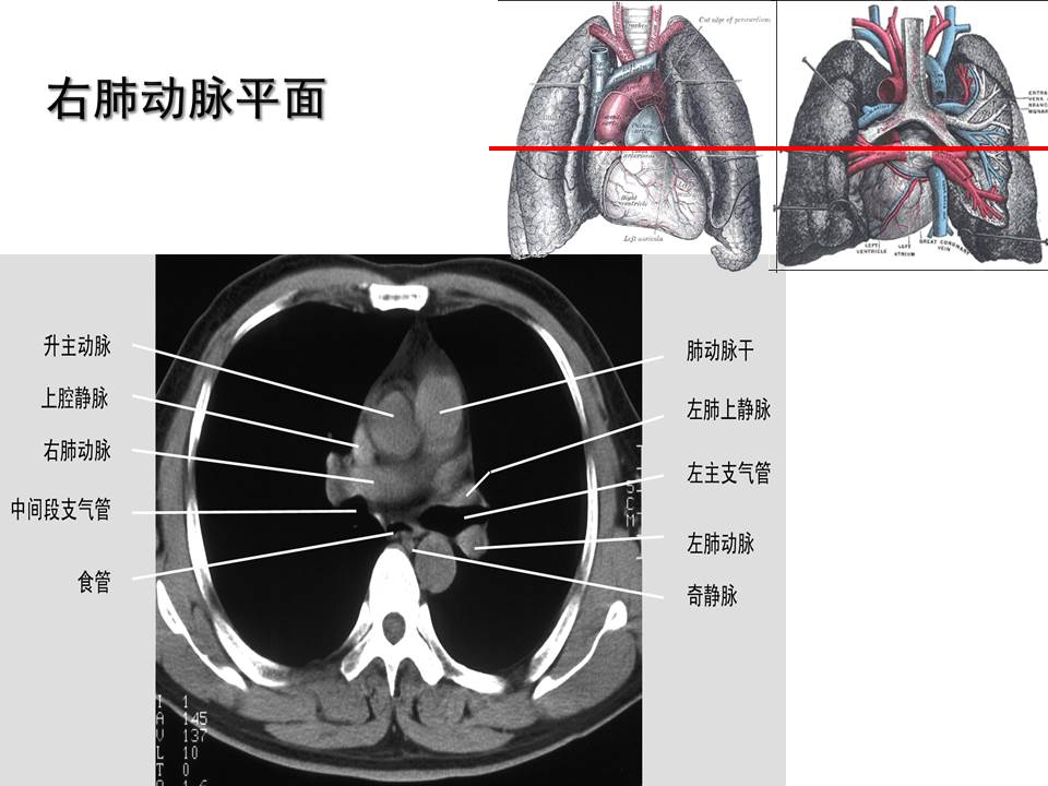 幻灯片43