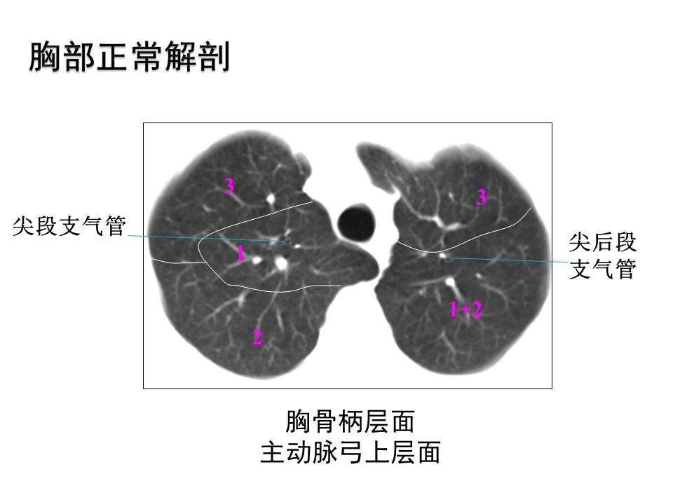 幻灯片52